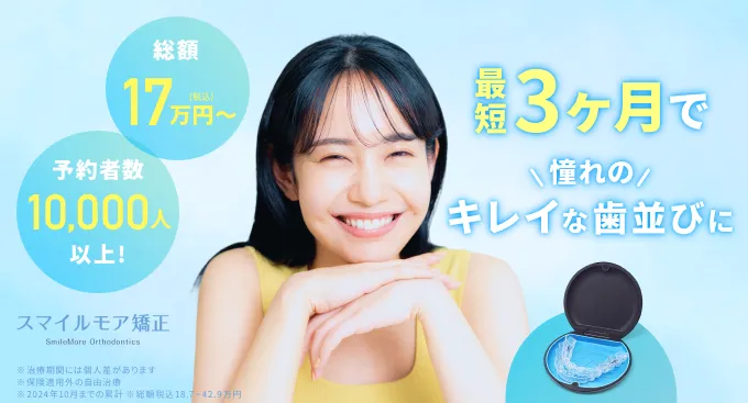 スマイルモア矯正